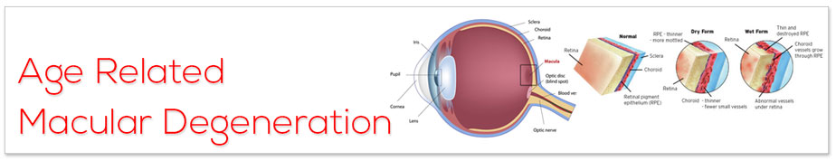 Viagra And Age Related Macular Degeneration